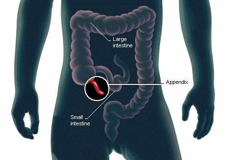 Appendix