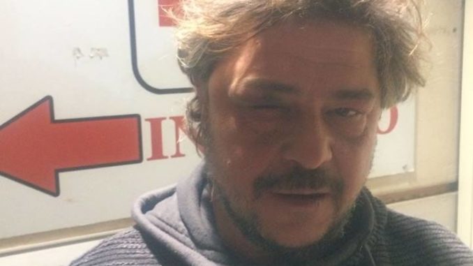 2018-02-07 Foto Tony Della Pia dopo pestaggio della PS