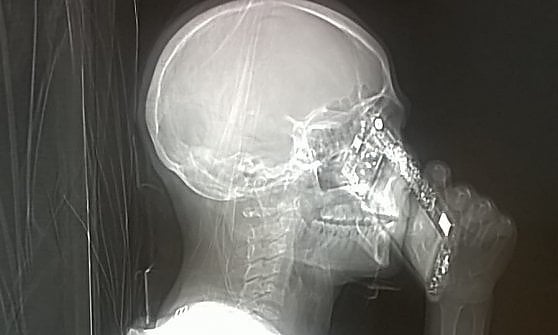 215045434-bc3c841f-c43c-4d46-bcd2-b2b83d382dfd