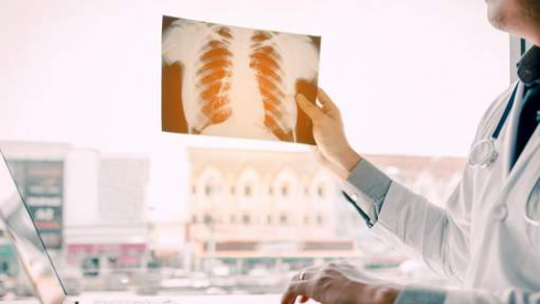 tumore_polonare_93901421a6a5f23302217e06bbbbed98