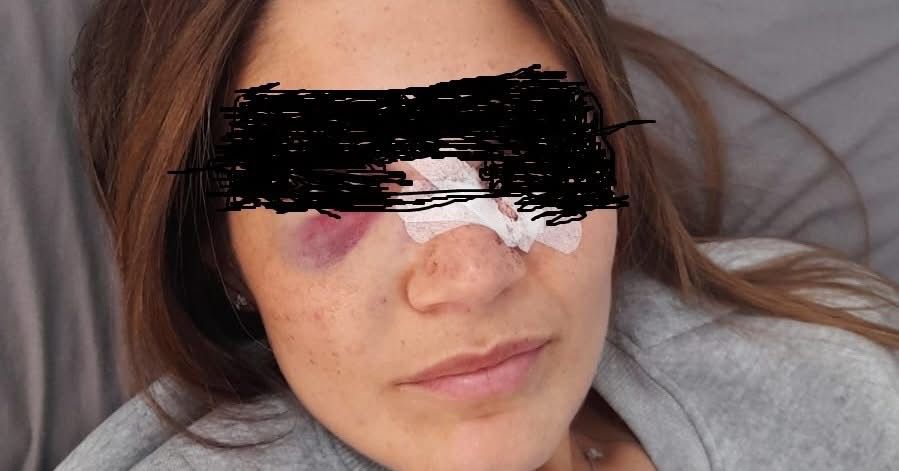 Fuorigrotta, bottiglia lanciata tra la folla fuori dallo stadio Maradona: donna ferita, si cerca il responsabile