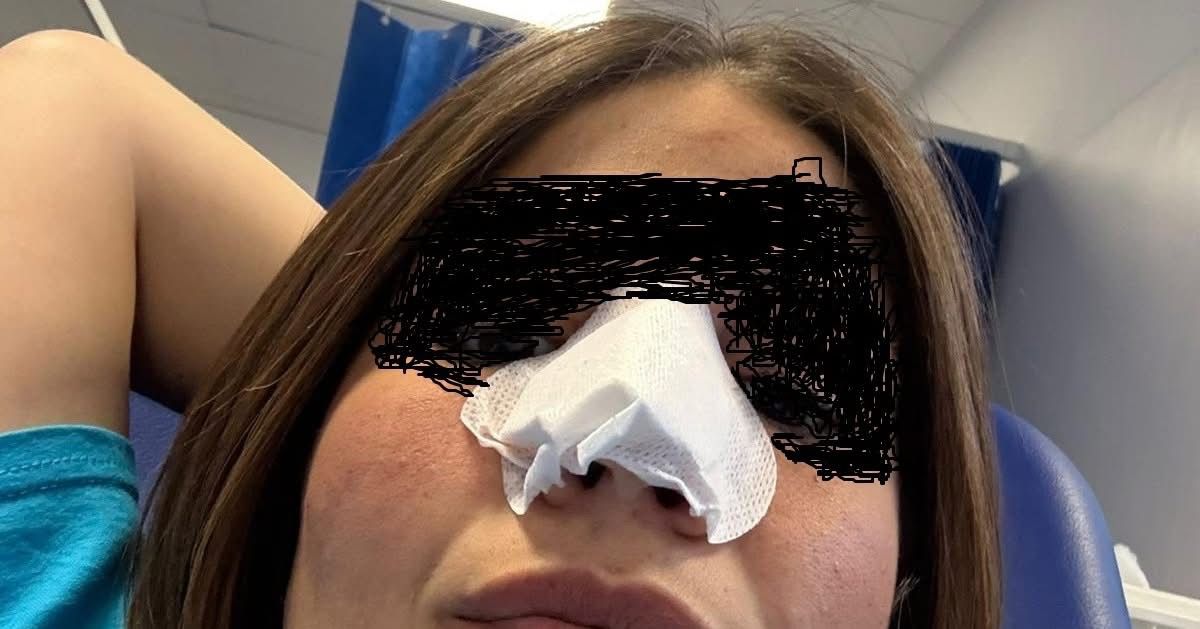 Fuorigrotta, bottiglia lanciata tra la folla fuori dallo stadio Maradona: donna ferita, si cerca il responsabile