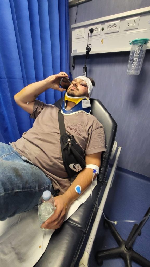 Napoli, ciclista investito da un pirata della strada nella Galleria Vittoria: polemiche sulle telecamere non funzionanti Napoli, ciclista investito da un pirata della strada nella Galleria Vittoria: polemiche sulle telecamere non funzionanti