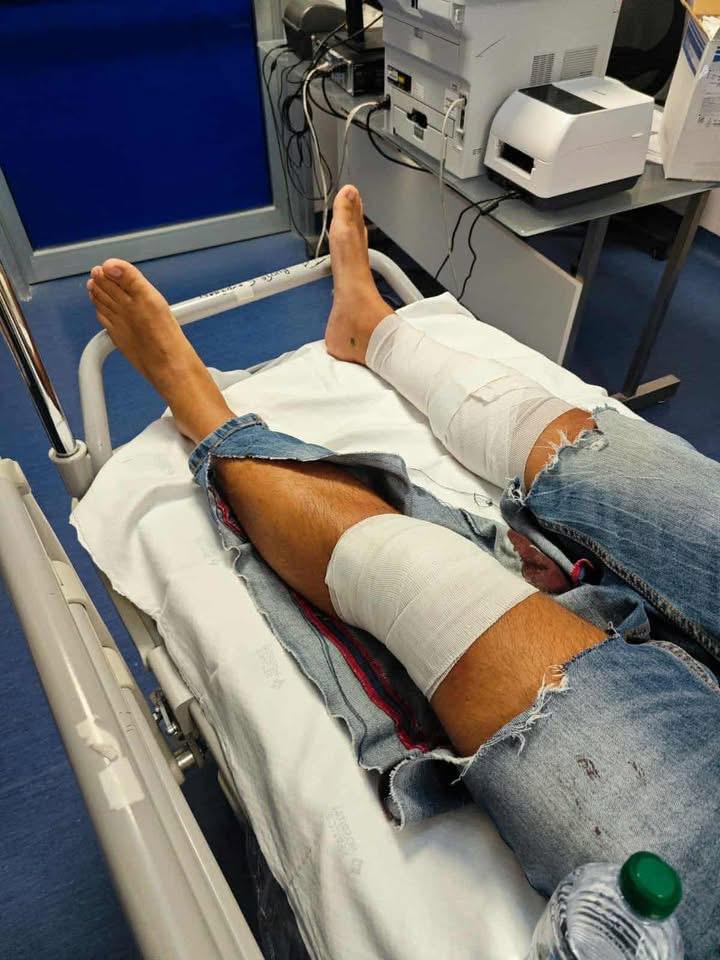 Marigliano, aggredito e pestato per un’auto: trentenne massacrato sull’Asse Mediano. Borrelli: “Una città ormai ostaggio della violenza”