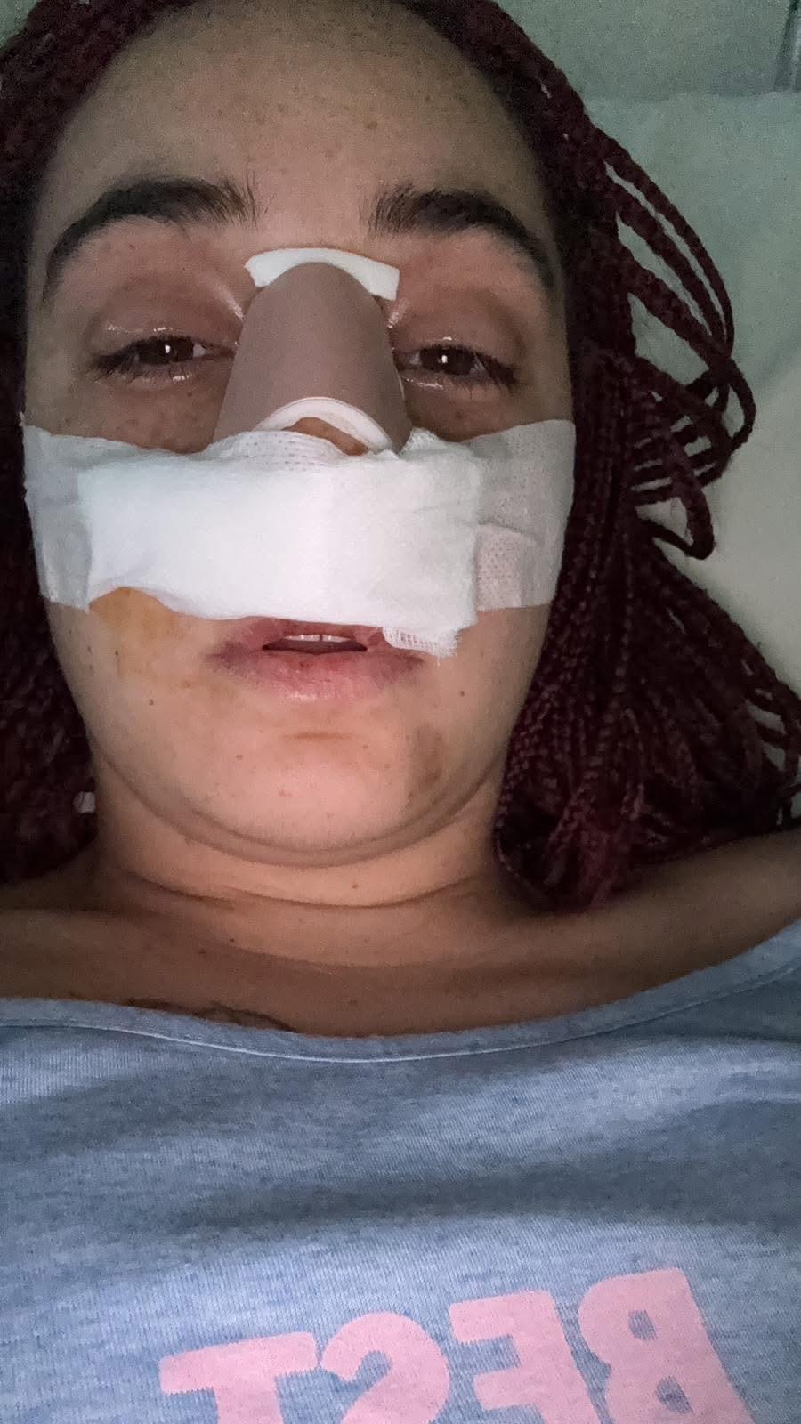 Brusciano, donna massacrata dal marito: salvata in extremis grazie alla figlia. Borrelli (AVS): “Servono pene certe e protezione immediata per chi trova il coraggio di denunciare”