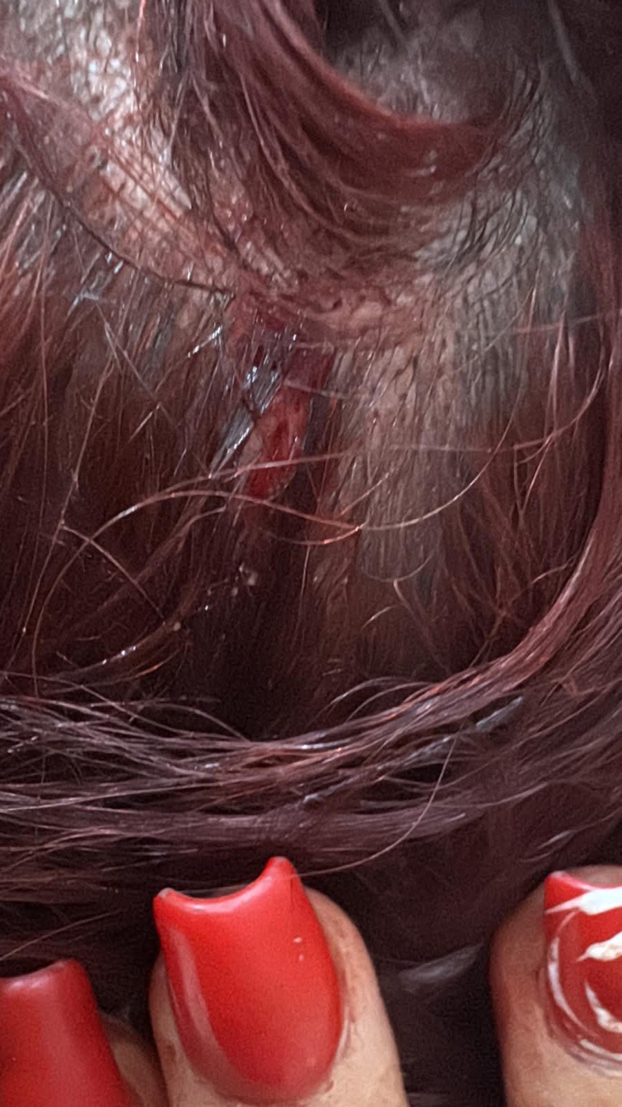 Brusciano, donna massacrata dal marito: salvata in extremis grazie alla figlia. Borrelli (AVS): “Servono pene certe e protezione immediata per chi trova il coraggio di denunciare”