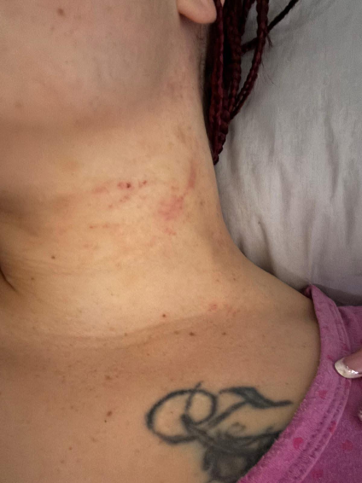 Brusciano, donna massacrata dal marito: salvata in extremis grazie alla figlia. Borrelli (AVS): “Servono pene certe e protezione immediata per chi trova il coraggio di denunciare”