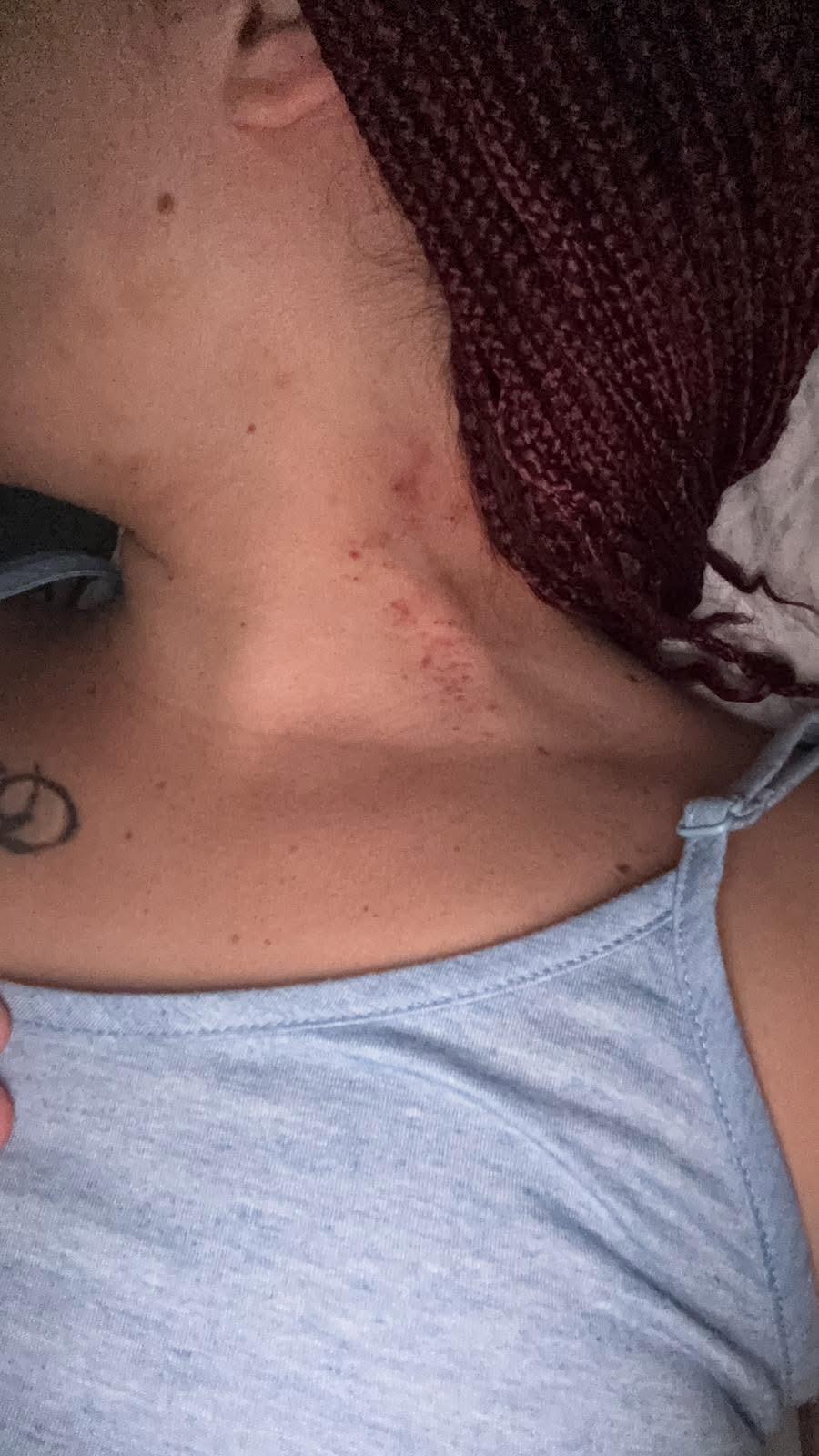 Brusciano, donna massacrata dal marito: salvata in extremis grazie alla figlia. Borrelli (AVS): “Servono pene certe e protezione immediata per chi trova il coraggio di denunciare”