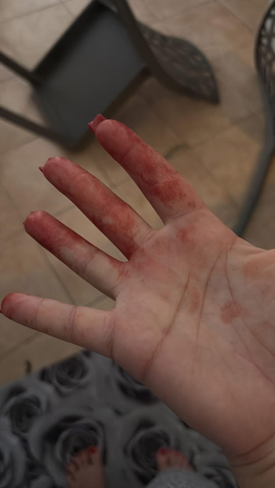 Brusciano, donna massacrata dal marito: salvata in extremis grazie alla figlia. Borrelli (AVS): “Servono pene certe e protezione immediata per chi trova il coraggio di denunciare”